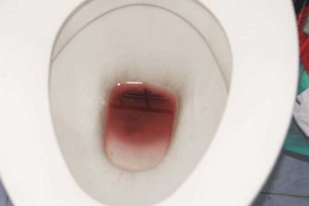 дамки кај мажите кога се возбудени